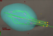 New Targeted Treatment for Breast and Gynecologic Cancers Delivers Care Closer to Home