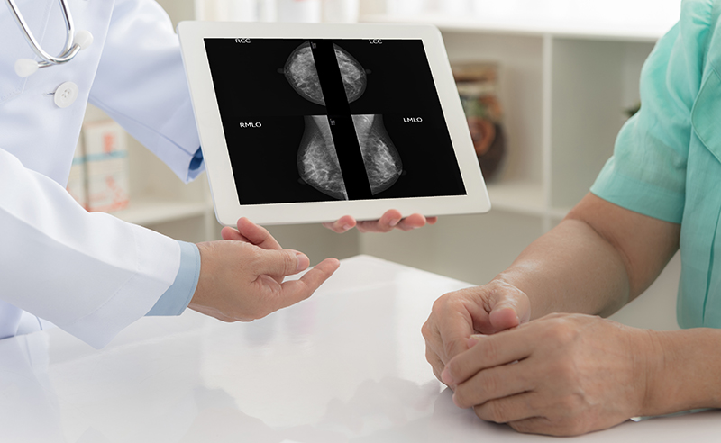 Catching Breast Cancer Earlier: 3D Breast Imaging Can Boost Cancer Detection Rates