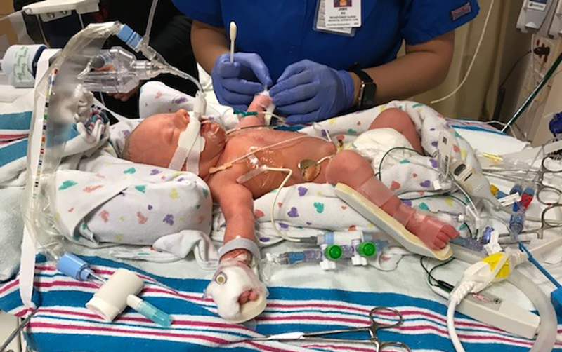Getting Preemie Babies Off to a Strong Start, Parents Rely on Valley’s NICU Team to Deliver Expert Care