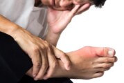 Understanding Gout