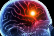 Why Stroke Care is Better than Ever in Our Community