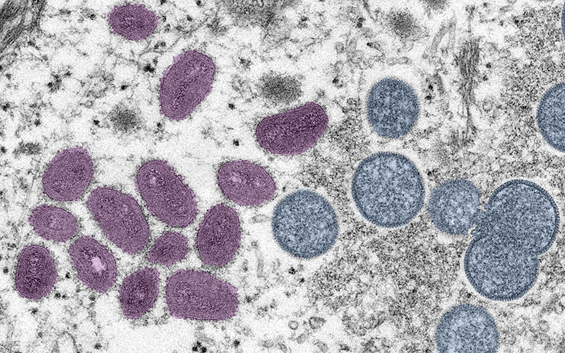 monkeypox-colorized-CDC_blog